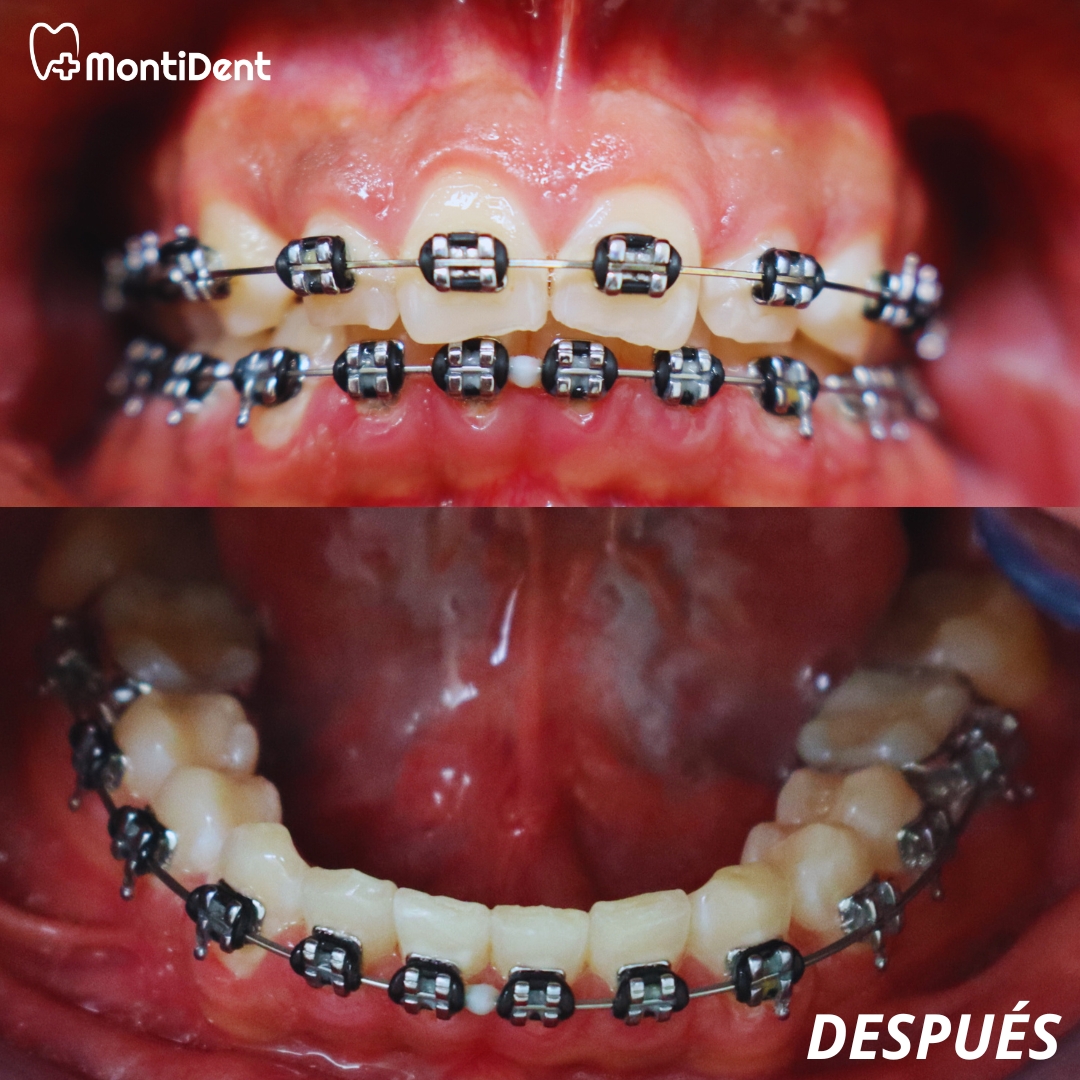 montident_daniel_montiel_garcia