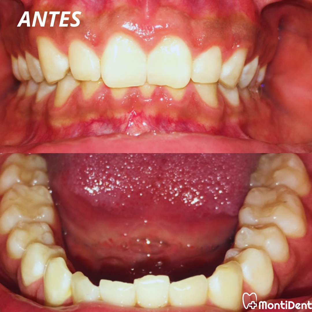 montident_daniel_montiel_garcia